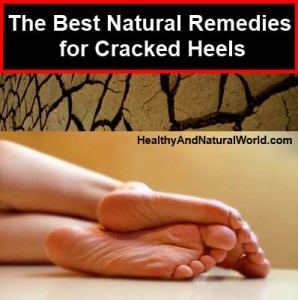 Best Cure For Cracked Heel